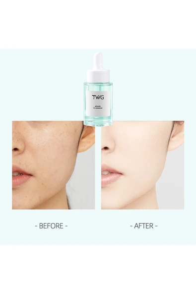 TWG Arbutin C Vitaminli Yüz Serumu - 4