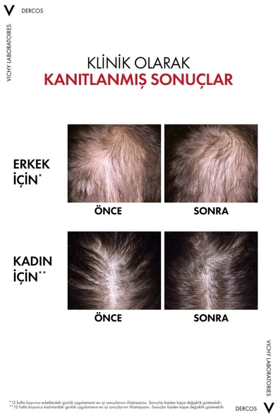 Vichy Aminexil R.E.G.E.N Booster Yenilikçi Saç Dökülmesine Karşı Bakım Serumu 90 ml - 3