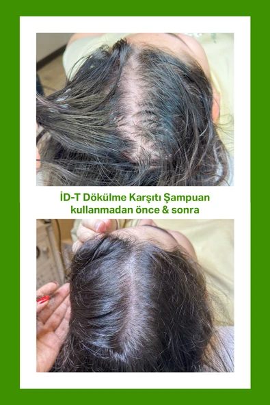 Dökülme Karşıtı Şampuan Hızlı Saç Uzaması Biotin Ve Keratin - 3