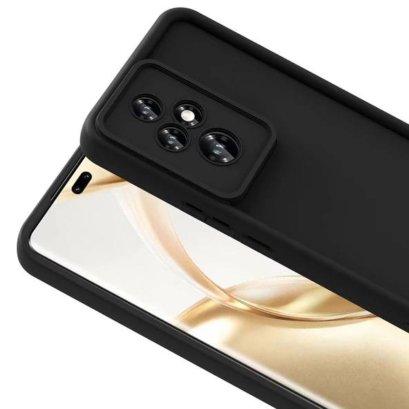 Royal Cover iPhone 15 Pro Max Kılıf Yumuşak Dokulu ve Esnek Şık Silikon Kapak RCV/Ananas - Resim 5