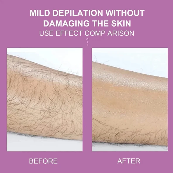 pilelistore Epilatör Kristal Epilasyon Aleti - 2