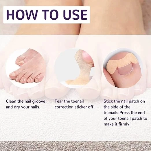 MDB Ayak Tırnağı Düzeltme Bandı 50 Adet - Resim 4