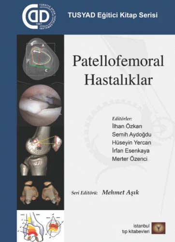TUSYAD Eğitici Kitap Serisi - Patellofemoral Hastalıklar ürün görseli