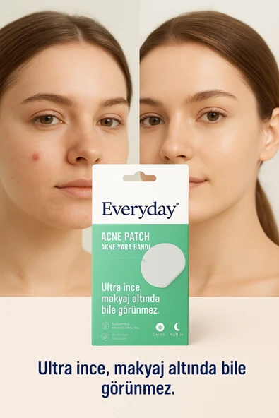 EVERYDAY Akne Bandı 36 Adet / Bandı - Pimple Patch- Hidrokolloid Bant - 3