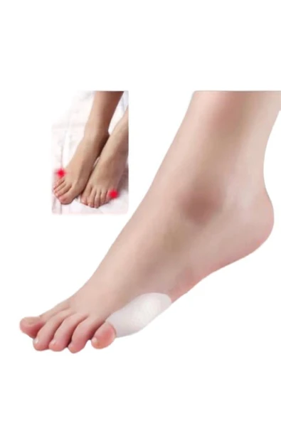 Ayak Serçe Parmak Bunyon Kemik Koruyucu Makarasız Nasır Yara Koruyucu - Resim 2