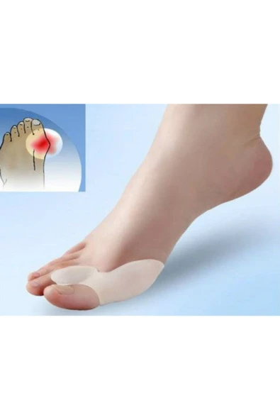 Ayak Baş Parmak Bunyon Koruyucu Makaralı Silikon Deforme Önleyici Ayak Baş Parmak Koruyucu 2 Li Set - Resim 4