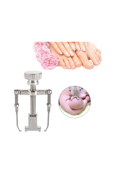 Batık Tırnak Çıkarıcı ve Düzeltici Aleti FC-037 - Resim 6