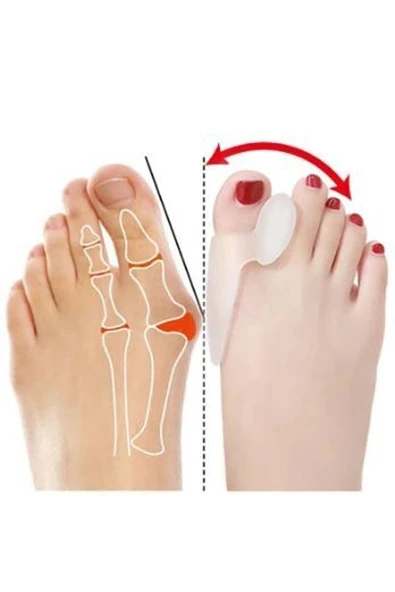 Ayak Bunyon Koruyucu Makaralı 2'li Set Silikon Bunyon Koruyucu - Resim 2