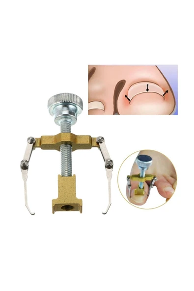 Batan Tırnak Düzeltme Aleti Batık Tırnak Çıkarıcı Aparat ürün görseli 1