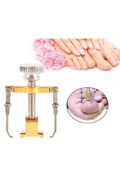 Batık Tırnak Çıkartıcı Ayak Tırnak Batması Düzeltici Pens Aparat - Resim 2