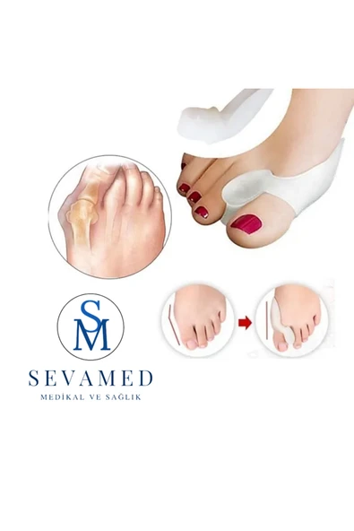 Ayak Baş Parmak Bunyon Koruyucu Makaralı 2 Li Set Koruma Aparatı ürün görseli 1