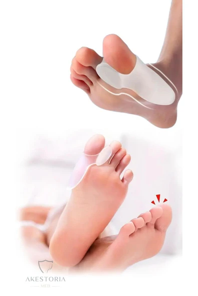 Çift Makaralı Bunyon Baş Parmak Düzeltici Ateli Kemik Koruyucu Küçük 2'li Fc-007 - Resim 2