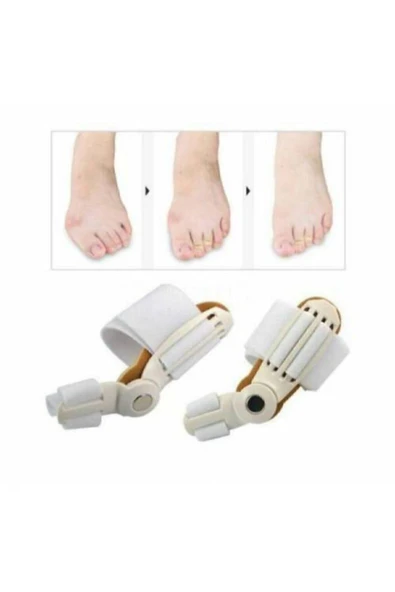 Ayak Bunyon Baş Parmak Kemik Koruyucu - Makaralı Kemik Düzeltici - 1 Adet Krem ürün görseli 1