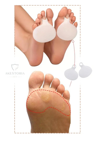 Çift Orta Parmak Metatarsal Silikonlu Pedi Yastığı Nasır Koruyucu Fc-017 ürün görseli 1