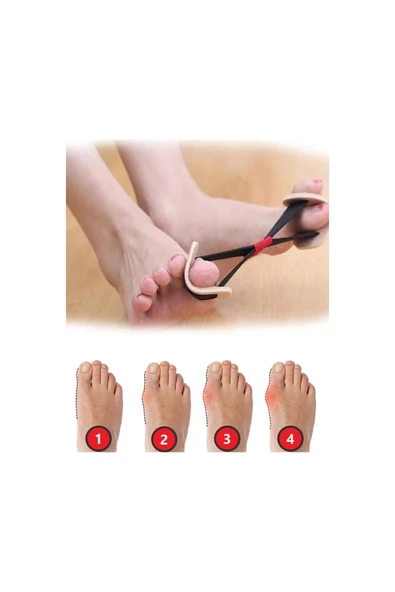 Ayak Baş Parmak Kemik Düzeltici Egzersiz Lastiği ürün görseli 1