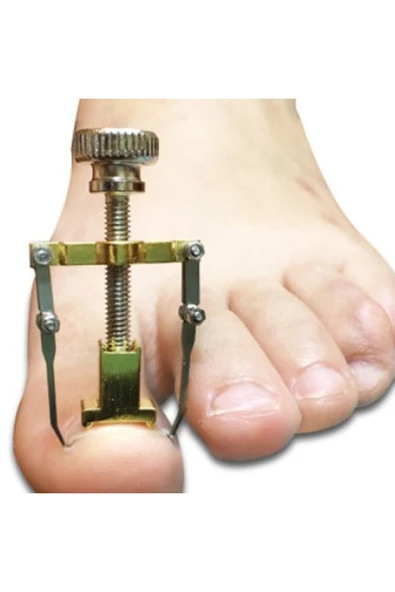 Batık Tırnak Çıkartıcı Aparat ürün görseli 1