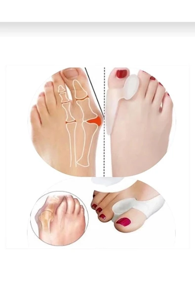 2li Silikon Jel Makaralı Ayak Başparmak Ateli Düzeltici Kemik Koruyucu Halluks Valgus Koruma Aparatı ürün görseli 1