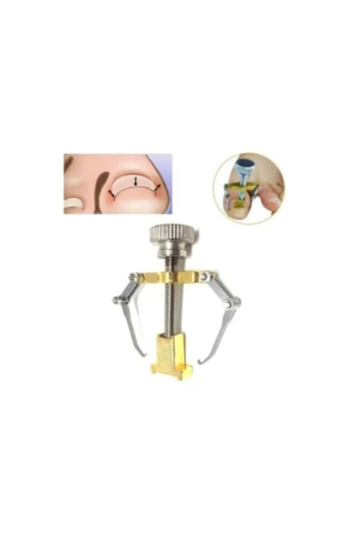 Batık Tırnak Çıkartıcı Aparat - Resim 3