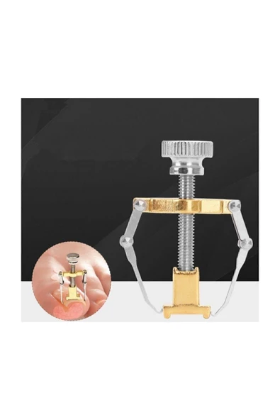 Batık Tırnak Düzeltme Aparatı Batan Tırnak Düzeltme Aleti Tırnak Batması Düzeltme Aleti ürün görseli 1