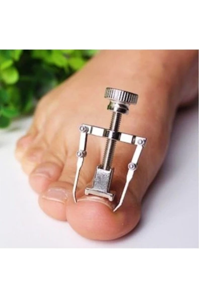 Batık Tırnak Çıkartıcı Aparat Gümüş - Resim 2