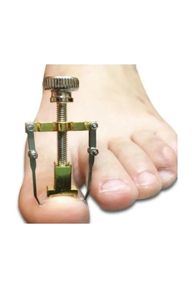 Batık Tırnak Çıkartıcı Ayak Tırnak Batması Düzeltici Pens Aparatı Orjinal Tırnak Çekme ürün görseli 1