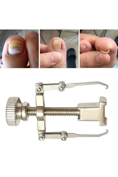 Batık Tırnak Düzeltme Aleti - Resim 4