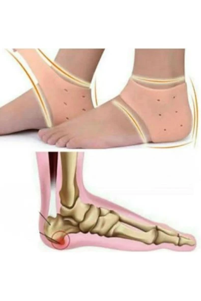 Ayak Sağlığı Baskı Azaltıcı Topuk Koruyucu Topuk Gömleği - Resim 3