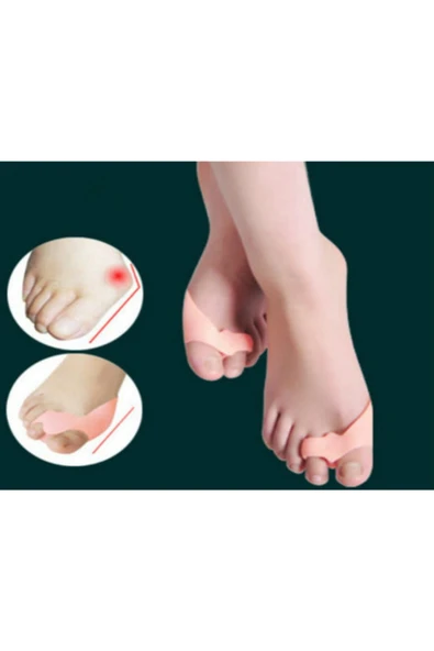 Ayak Bunyon Koruyucu 2 Parmağa Geçen Makaralı Set Ten Rengi - Resim 2