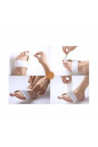 Ayak Bunyon Baş Parmak Kemik Koruyucu - Makaralı Kemik Düzeltici - 1 Adet Krem - Resim 3