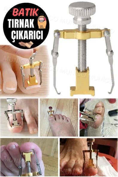 Kaliteli Çelik Düzeltici Evde Uygulama Kolaylığı Batık Tırnak Çıkartıcı Kullanıcı Dostu ve Dayanıklı - Resim 3