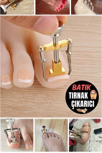 Kaliteli Çelik Düzeltici Evde Uygulama Kolaylığı Batık Tırnak Çıkartıcı Kullanıcı Dostu ve Dayanıklı - Resim 4