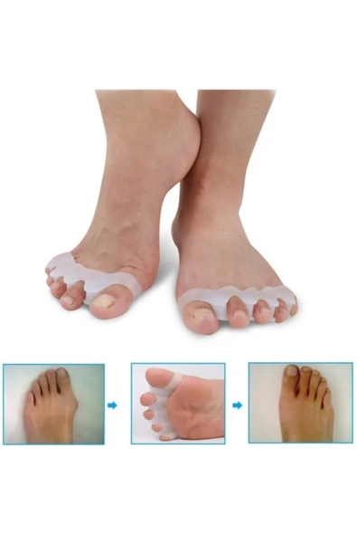 Nistyle Halluks Valgus Düzeltici 5 Parmak Ayırıcı Silikon Aparat - Resim 2