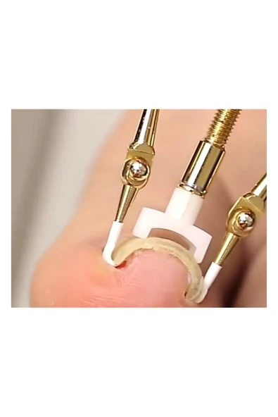 Mstz Ayak Batık Tırnak Çıkartıcı Aparat Zncm - Resim 5