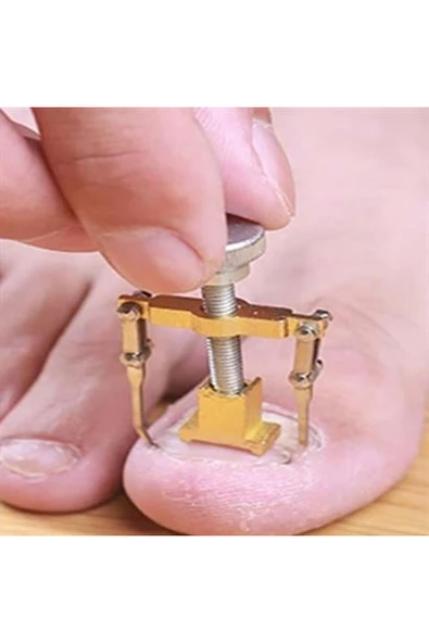 Shopzum Batan Tırnak Düzeltme Aleti Batık Tırnak Çıkarıcı Aparat ürün görseli 1