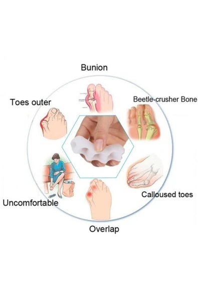 Nistyle Halluks Valgus Düzeltici 5 Parmak Ayırıcı Silikon Aparat - Resim 4