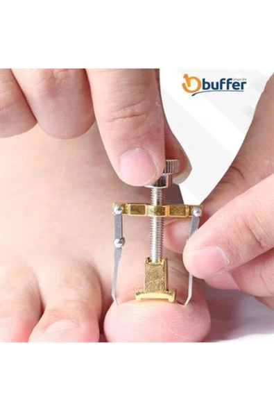 Shopzum Batan Tırnak Düzeltme Aleti Batık Tırnak Çıkarıcı Aparat - Resim 3