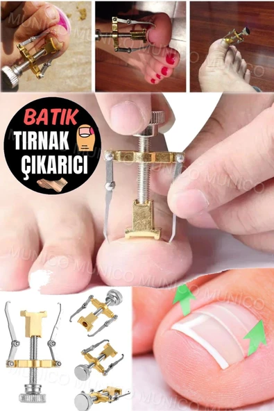 Kaliteli Çelik Düzeltici Evde Uygulama Kolaylığı Batık Tırnak Çıkartıcı Kullanıcı Dostu ve Dayanıklı ürün görseli 1