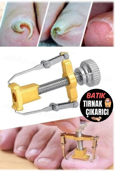Kaliteli Çelik Düzeltici Evde Uygulama Kolaylığı Batık Tırnak Çıkartıcı Kullanıcı Dostu ve Dayanıklı - Resim 6