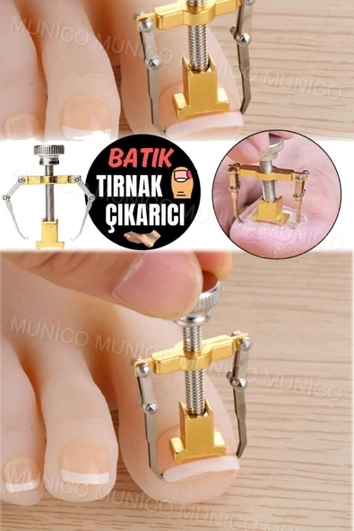 Kaliteli Çelik Düzeltici Evde Uygulama Kolaylığı Batık Tırnak Çıkartıcı Kullanıcı Dostu ve Dayanıklı - Resim 2