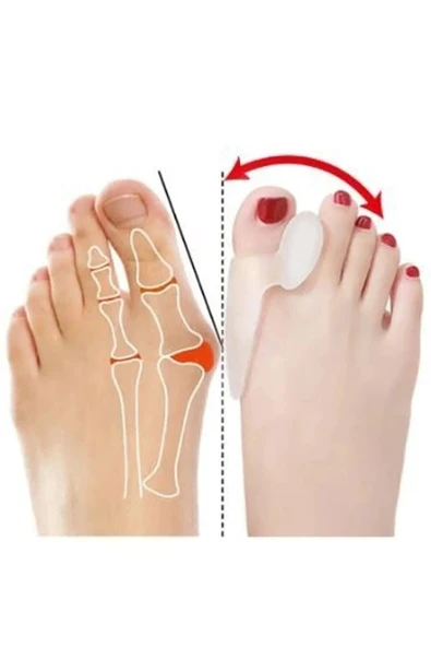 Silikon Makaralı Ayak Baş Parmak Kemik Bunyon Koruyucu - Resim 3