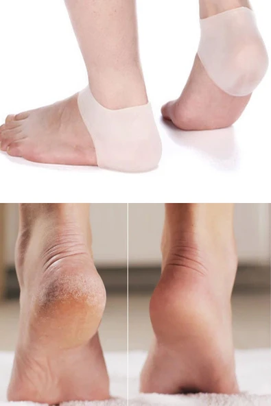 Slikon Topuk Koruması Yarım Çorap Ortopedik Topuk - Resim 2