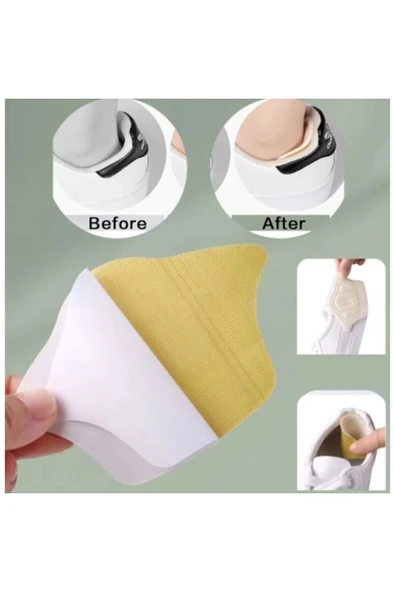 Taç Şeklinde Topuk Vurma Önleyici 5 mm. - Resim 3