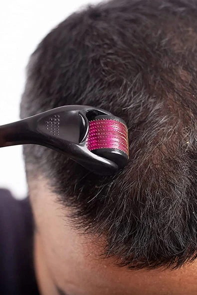 Titanyum Uçlu 540 İğneli Derma Roller 0.5 MM İğne Saç Sakal Çıkarma Tarağı - Resim 6