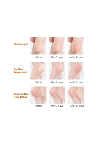 Silikon Topuk Nemlendirici Çorap - 4