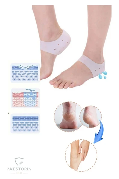 Silikon Topuk Gömleği Dikeni Çatlak Koruyucu Bandaj Ortopedik Ayak Destek Çorabı - Resim 3