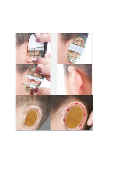 Su Geçirmez Yapışkanlı Kulak Koruyucu Bant 20 Adet - Resim 3