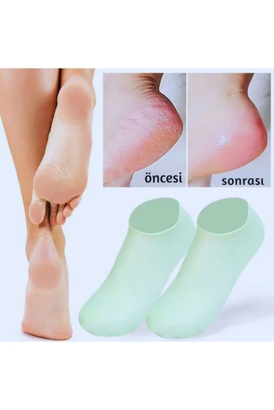 Silikon Topuk Bakım Çorabı Nemlendirici Spa Etkili Ayak Maskesi - 2