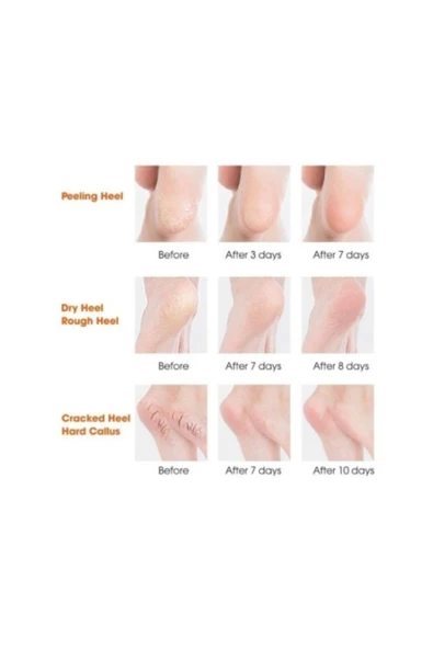 Silikon Topuk Nemlendirici Çorap - Resim 4