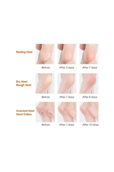 Silikon Topuk Nemlendirici Çorap - 3