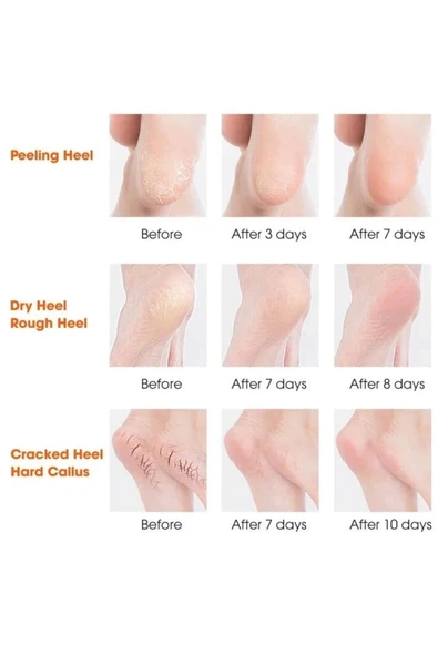 Silikon Topuk Nemlendirici Çorap - PRP5692-7889 - 2